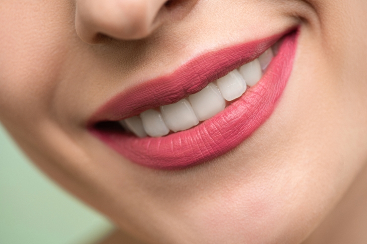 Smile-Designing-33 (1)